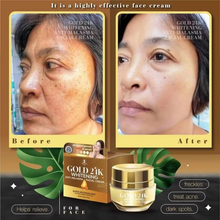 Precious Skin Gold 24K Whitening Cream- Anti-Melasma Luxury Treatment