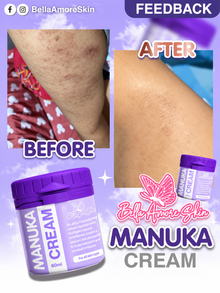 Bella Amore Skin- Manuka Cream (60ml)